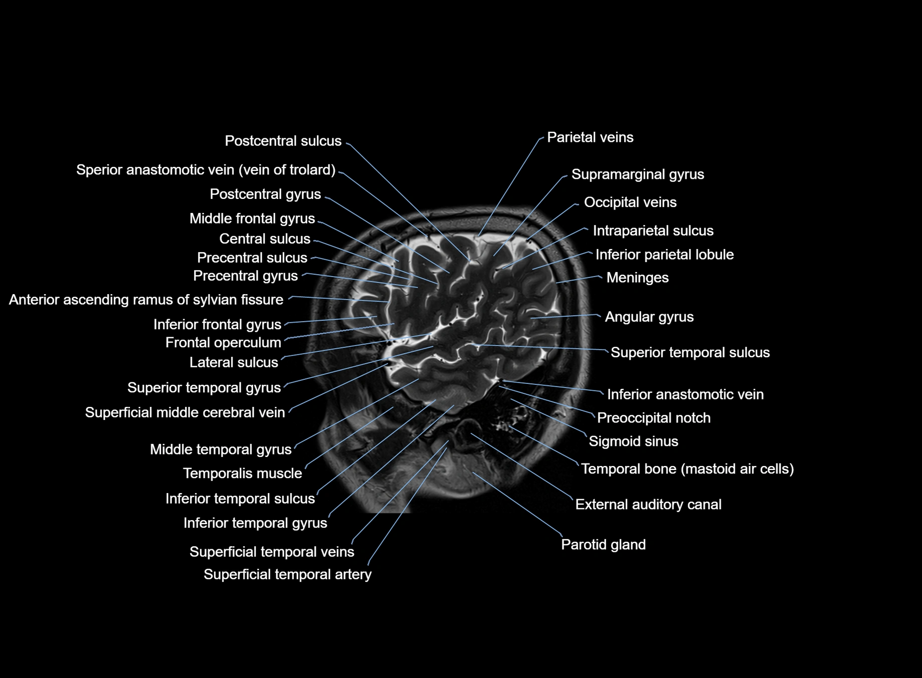 brain sagittal anatomy 3T MRI images -img-00001-00010.webp